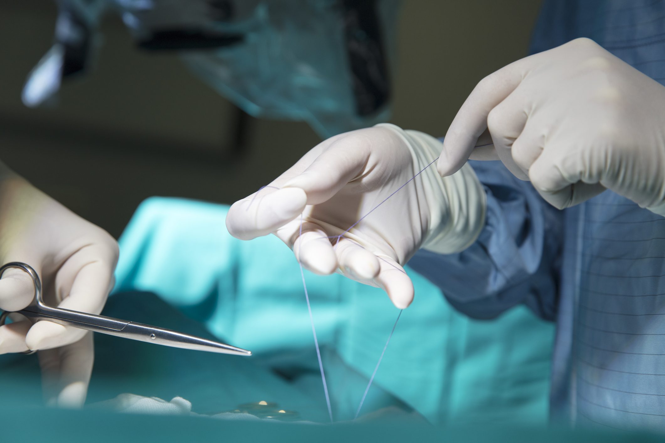 Surgical team stitching patient incision